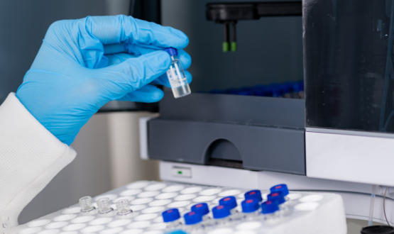 HPLC chromatography test