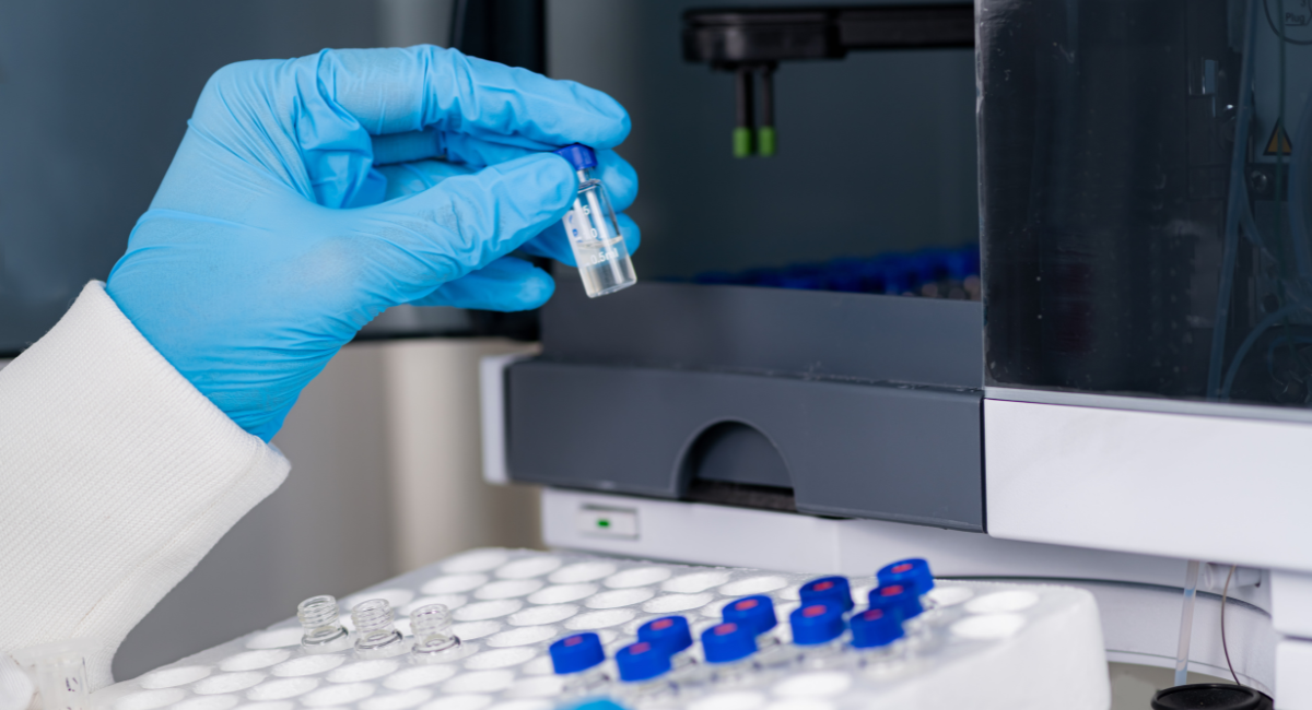 HPLC chromatography test